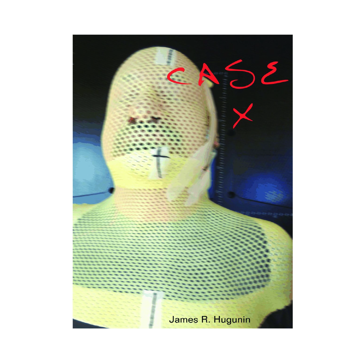 Case X (Novel) by James R. Hugunin